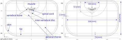 A novel current steering method for targeted spinal cord stimulation